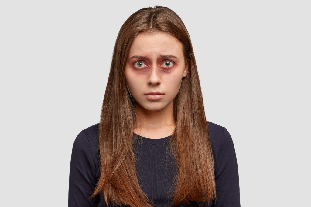 red eye