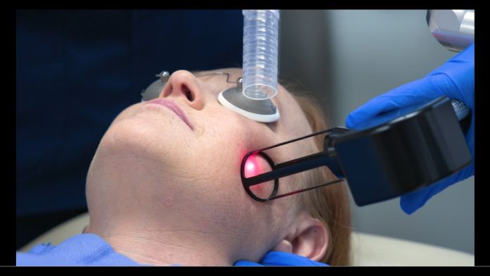 Is Fractional CO2 Laser Treatment Right For You
