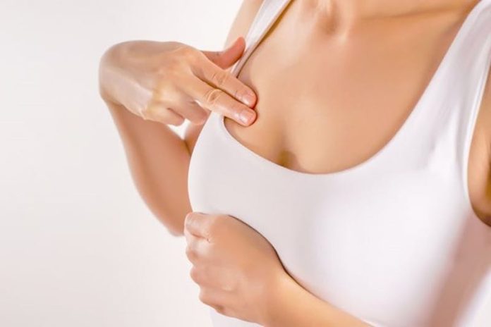 Breast Reduction: Step-by-Step Procedure Guide
