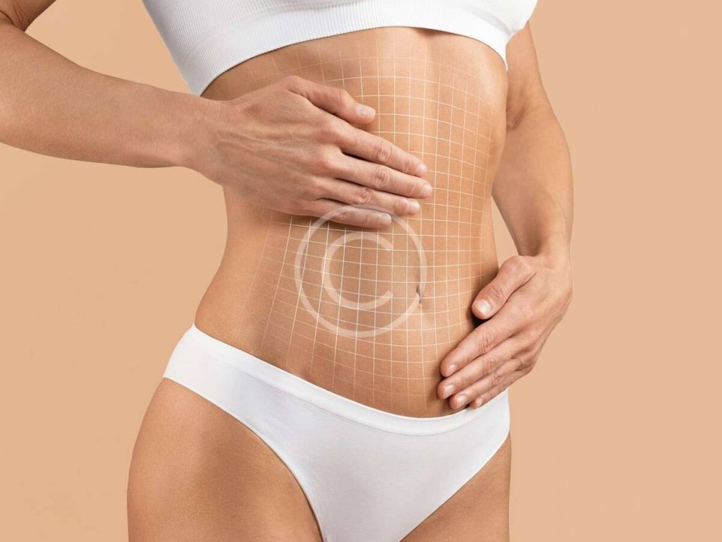 كيفية تدليك النسيج الندبي بعد شد البطن