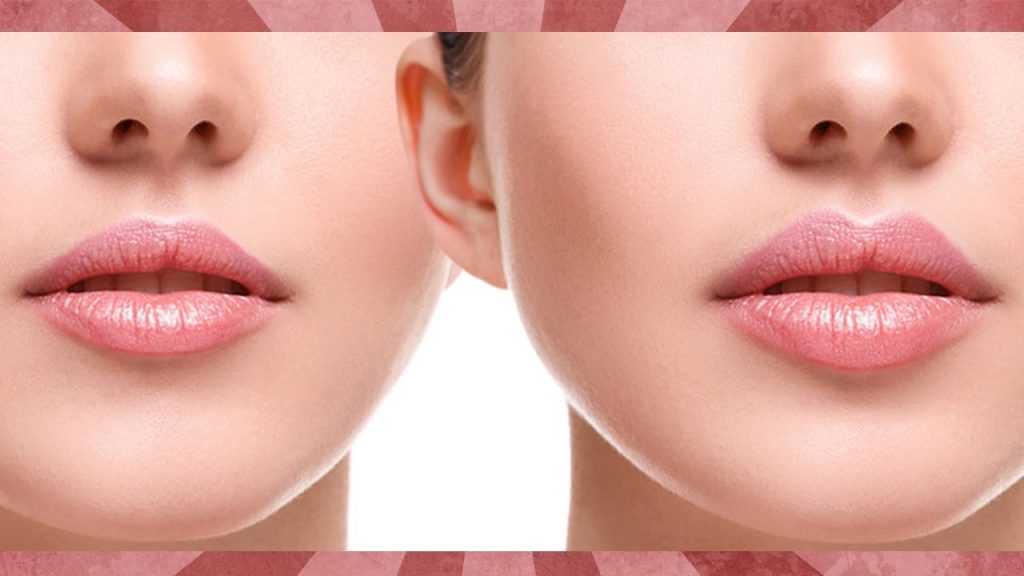 Lip Reshaping Treatments Islamabad