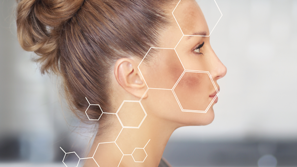 Melasma Treatment: Before and After Insights
