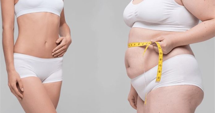 Weight Loss treatment in Islamabad